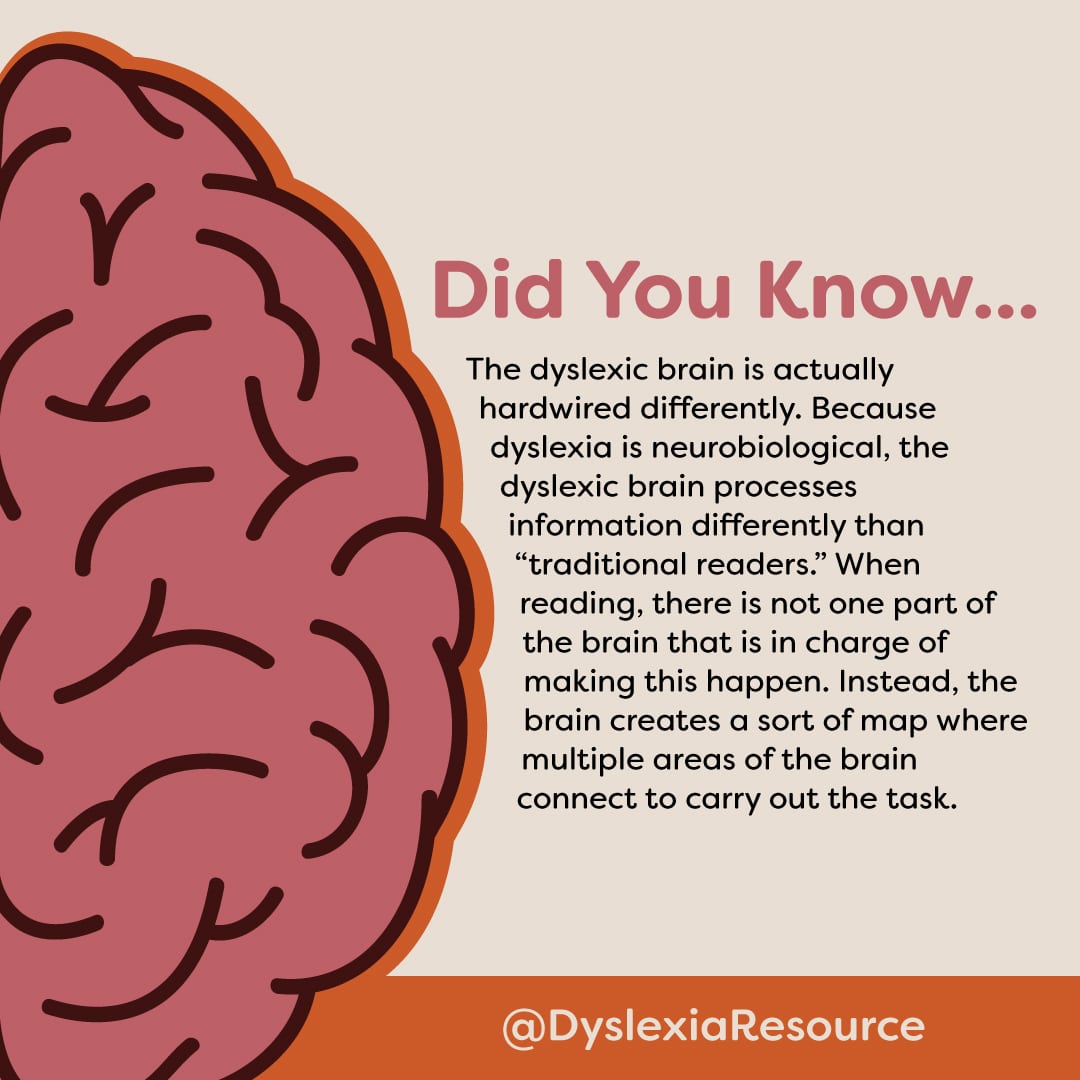 The Dyslexic Brain Is Hardwired Differently | ReadSource | Dyslexia Awareness Month